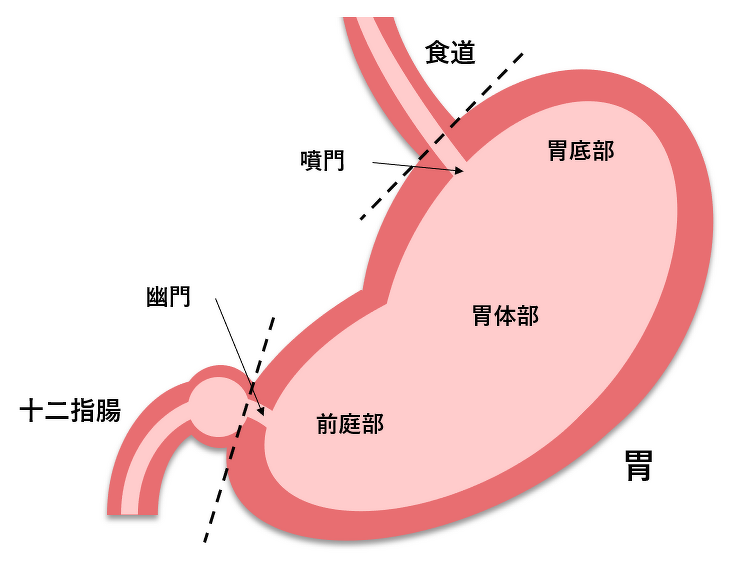 胃がん | 倉敷市 チクバ外科・胃腸科・肛門科病院